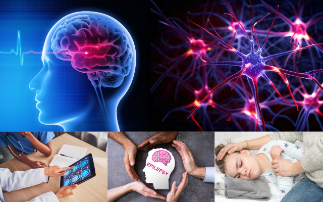 Epilepsy - Awareness and Providing Support